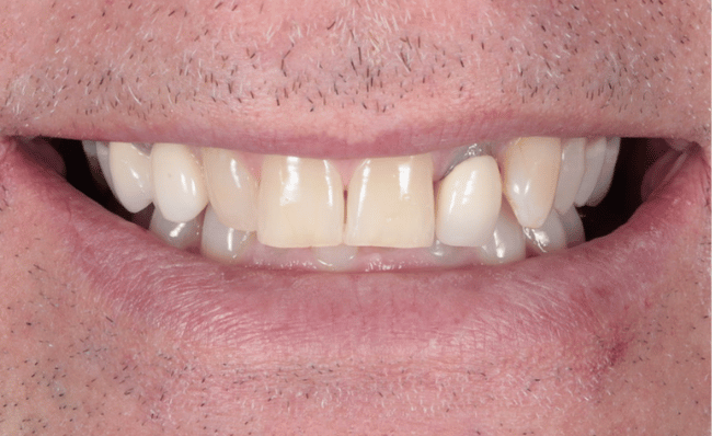 Digital smile design